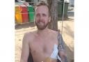 Adam Davies from Dinas Cross was badly injured in a motorbike crash in Thailand. Picture: Davies family
