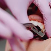 The decision by two local dentists to stop providing NHS treatments has been slammed.